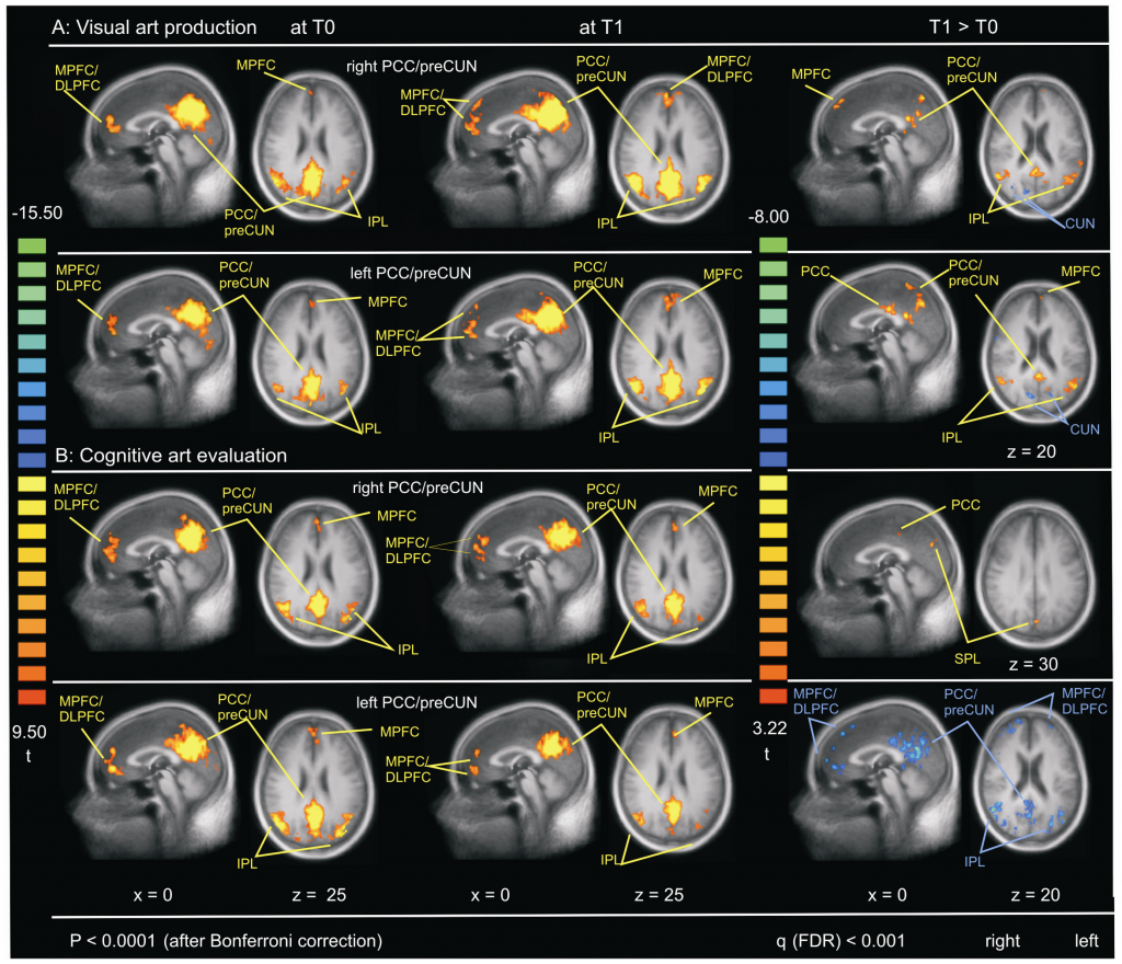 Can Creating Art Improve Brain Function and Well-being? Seems so ...